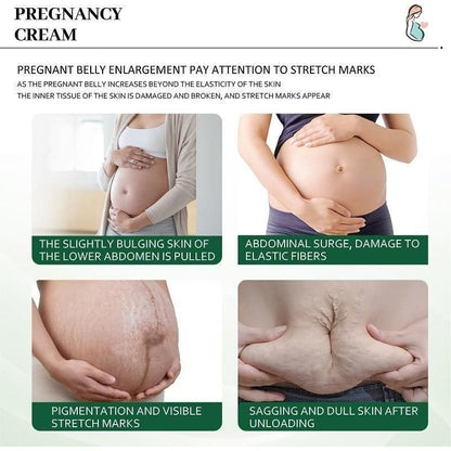 KURAI Pregnancy Scars, Acne Remove Cream