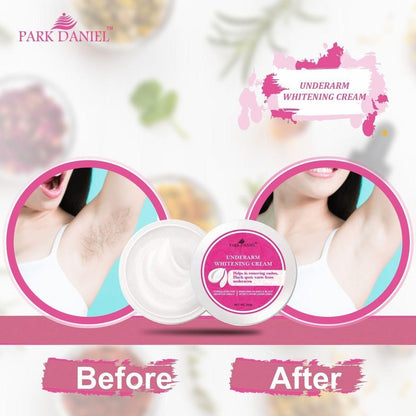 Park Daniel Underarms Darkness Lightening Cream Enriched with Kojic Acid, Nicinamide For Skin (100 grams)